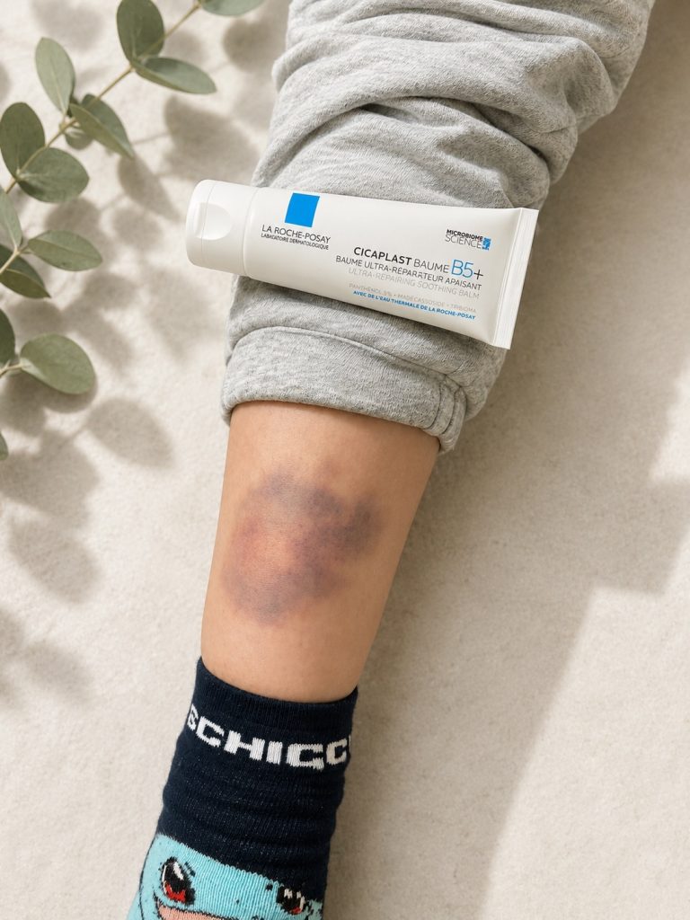 La Roche Posay Cicaplast Baume B5+ nach einem Kindersturz im Familienalltag